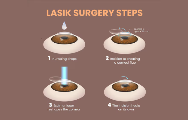 LASIK-Enhancements
